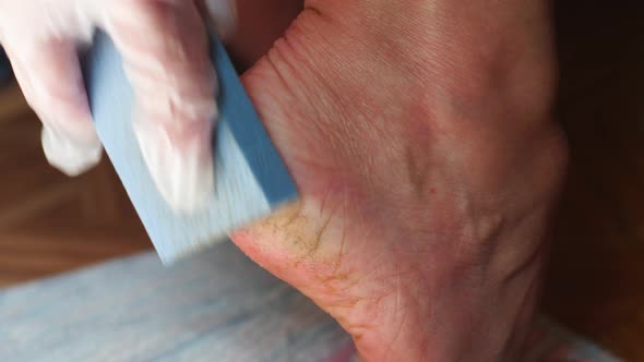 Close-up of a hand rubbing a pumice stone on the heel of the foot with dry skin, foot heel care, cos
