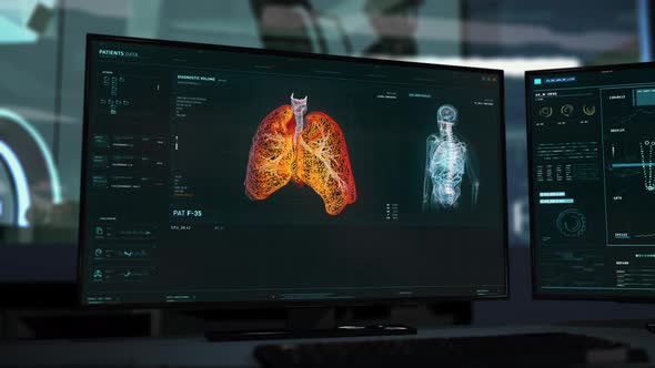 Identifying the Covid-19 Virus after the Structural Analysis of the Human Lungs alt