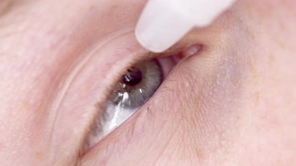Closeup Young Man Drops Eye Drops Install Lenses Moisturizing Using Medical Eyes Drops Suffering