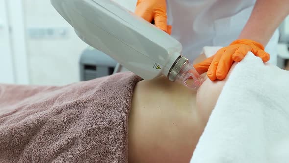 Woman Getting a Laser Skin Treatment or Laser Resurfacing of Scars in a Skincare Cosmetology Clinic