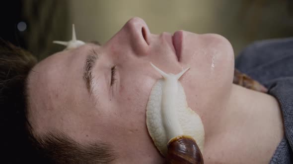 Close Portrait of Man Receiving Skin Rejuvenation with Crawling Snails on Face