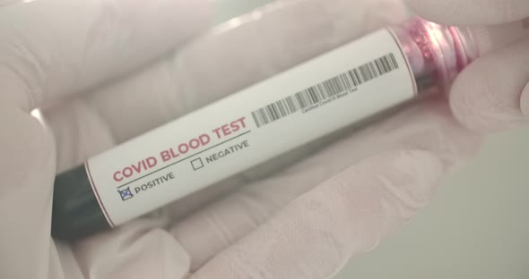 Blood Test in Hand