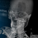 The Skeleton - VideoHive Item for Sale