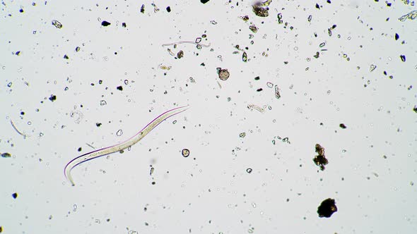 The Small Nematode is Wiggling in the Moss Water with Algae Under Microscope