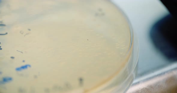 Scientist Looking at Bacteries in Petri Dish at Laboratory