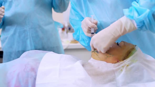 Team of Surgeons Prepairing Patient Before Before Plastic Surgery Making Injection in Face with