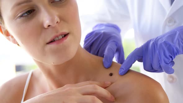 Woman therapist pointing a mole of her patient