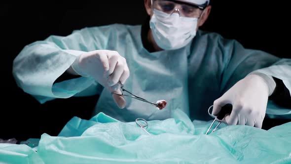 Doctor's Hand Holding a Wad of Blood with a Clip and Pulling It Out. Doctor Performs a Closeup