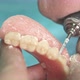 Dentist Makes a Dental Implant Prosthesis Made of Plaster Cast - VideoHive Item for Sale