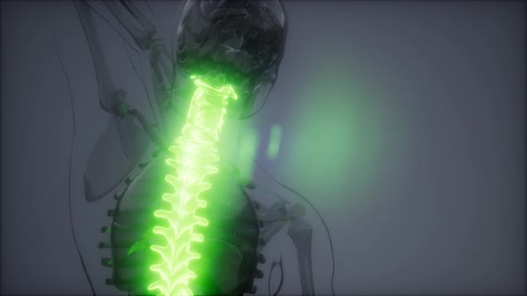 Backache in Back Bones