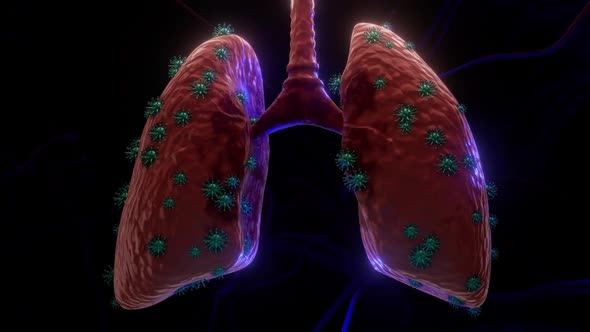 The Virus Is Destroying The Lungs