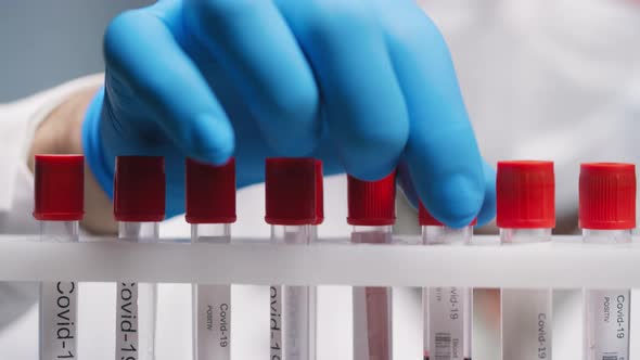 Biomedical Scientist Studying Blood Samples in Test Tubes