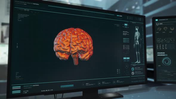 Patients Head Examination By Futuristic Ultrasound Scanner At Medical Laboratory