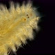 a Worm of the Chrysopetalidae Family Under a Microscope, Class Polychaeta, Possibly the Genus - VideoHive Item for Sale