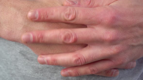 Dry cracked skin of male hands close up