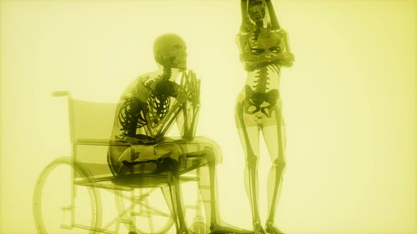 Man in Wheelchair with Visible Bones