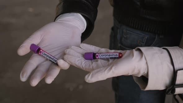 Closeup of a Couple in Gloves Holding Ampoules with a Blood Test for Covid