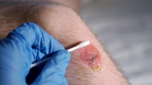 Doctor Checking Wound on Knee