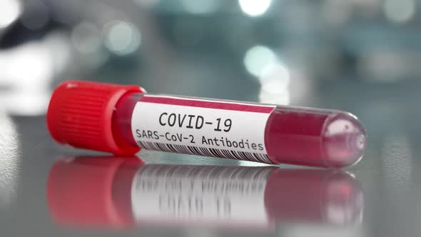 Covid-19 SARS-cov-2 antibodies vial in medical lab