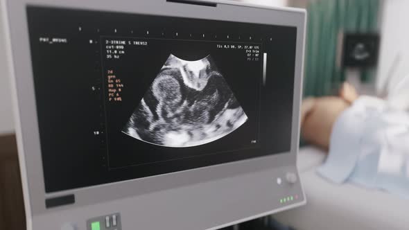 Ultrasound Scanner Device Used For Infants Health Examination At Hospital alt