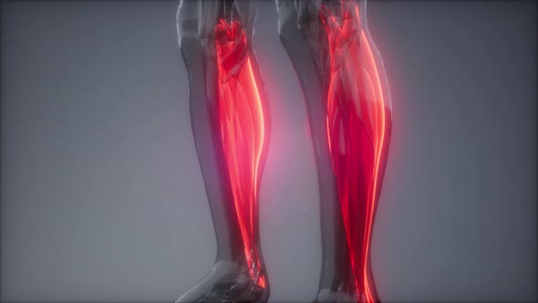 Gastrocnemius Visible Muscle Anatomy Map alt