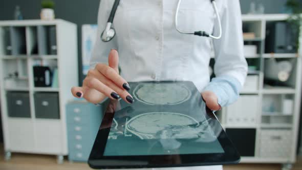 Close-up of Female Doctor's Hand Touching Tablet Screen Checking MRI Results of Patient