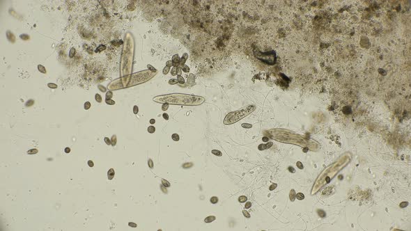 a Large Colony of Ciliates Coleps, Which Are Largely Located in Dirty Water Under a Microscope