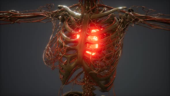 CG Animation Of A Sick Human Heart