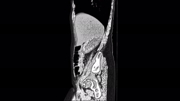 Contrast MRI of the Abdominal Cavity, Gastrointestinal Tract, Bladder