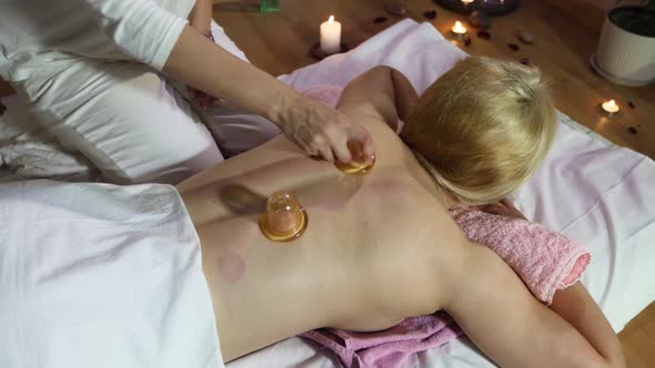 Cupping Massage.