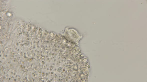 Movement of the Infusorian Trichodina