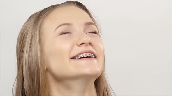 Woman Laughs and Shows Her Smile with Braces. White. Slow Motion