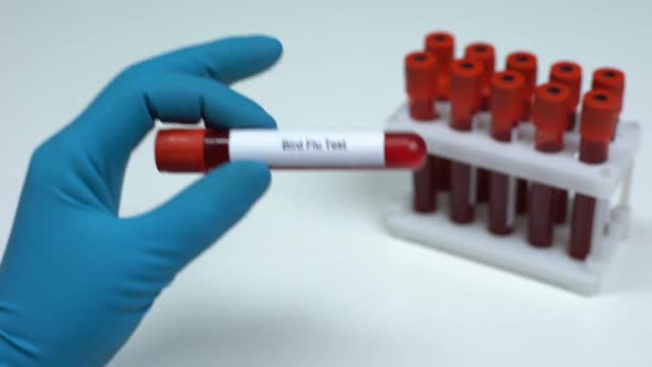 Bird Flu Test, Doctor Showing Blood Sample in Tube, Lab Research Health Check-Up