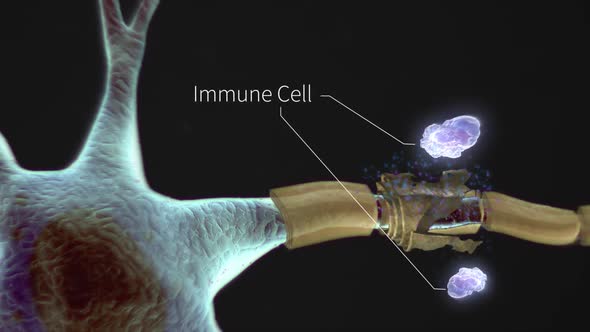 The Human nervous system 3d medical animation