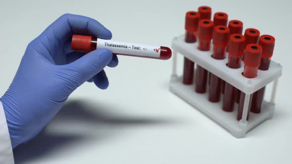 Positive Thalassemia Test, Doctor Showing Blood Sample in Tube, Health Checkup