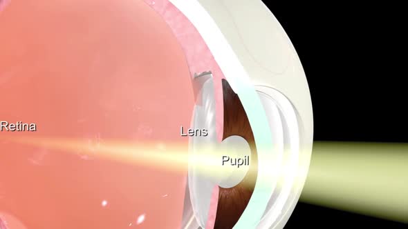 Anatomy of the Eye. Loss of vision in the eye