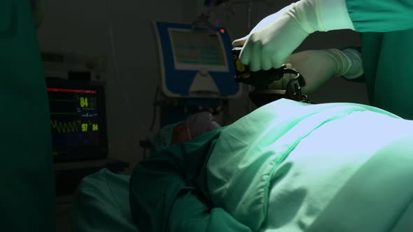 A team of doctors in the operating room performs CPR on a patient