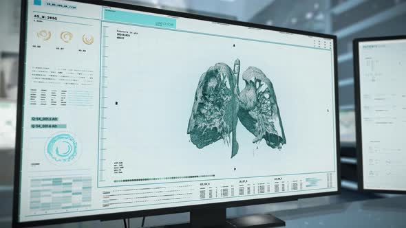 Patients Lungs High Tech Medical Scan In Health Care Monitoring Hospital alt