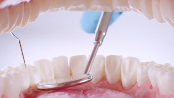 Dentist Inspects Teeth with Probe and Mirror