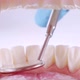 Dentist Inspects Teeth with Probe and Mirror - VideoHive Item for Sale