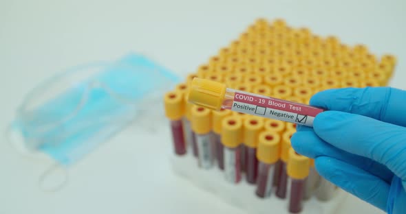 Researcher Hand Showing Tube, Negative Result of Blood Test for Coronavirus, Covid-2