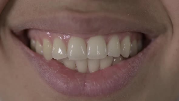 Close Up of African American Woman Teeth and Smiling