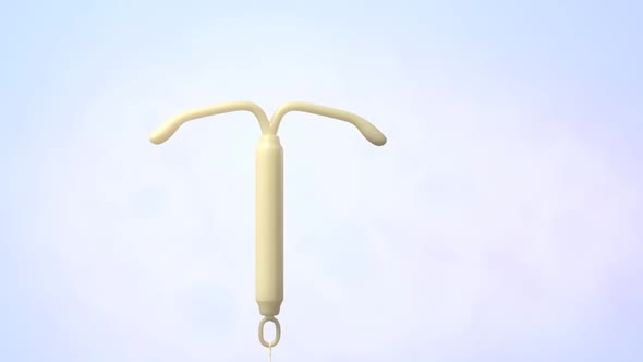 birth control device (IUD)