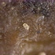 Soil Mites of the Acaridae Family Under a Microscope - VideoHive Item for Sale