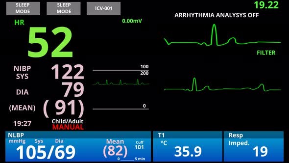 Patient Dies, Pulse Down, Medical Vital Signs Monitor, Cardio Sensor Diagnostic