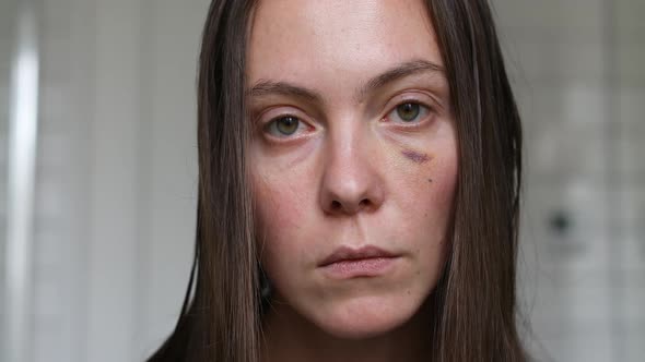 Woman with Black Eye Closeup Portrait