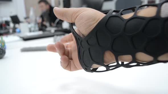 Black Orthopedic Plastic Prosthesis Printed on Powder 3D Printer on Hand