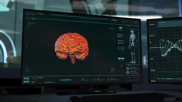 Human Brain Scan In Modern Medical Screening System For Health Care Research