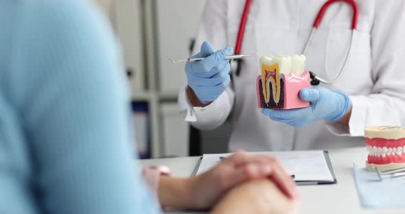 Dentist Doctor Shows Dental Model with Caries to Patient  Movie