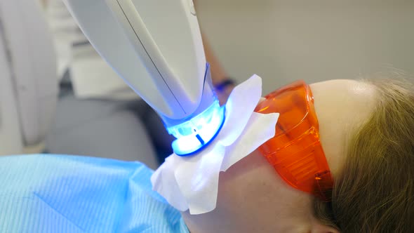 Professional Teeth Whitening or Bleaching Procedure in Modern Dental Clinic